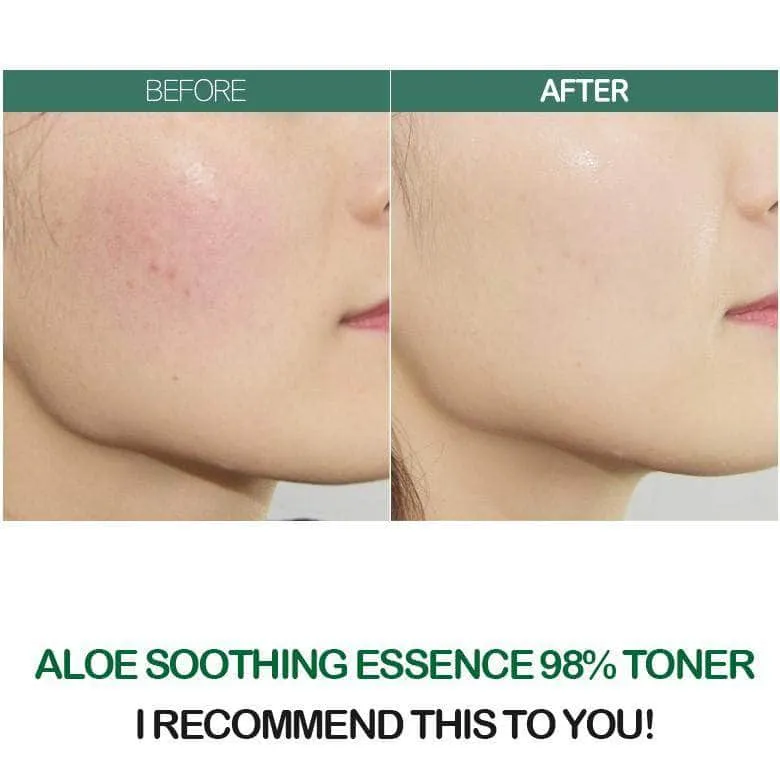 Aloe Soothing Essence Skin Care Special Set