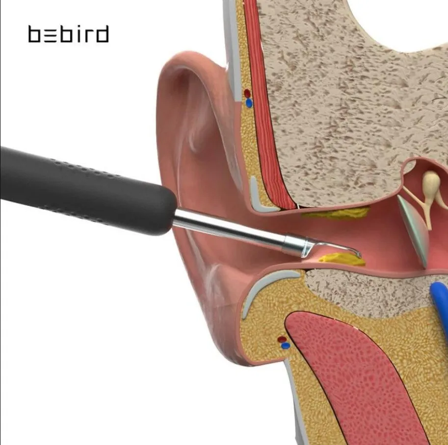 Bebird R1 Smart Visual Ear Sticks Endoscope Ear Picker Tool Set - Black
